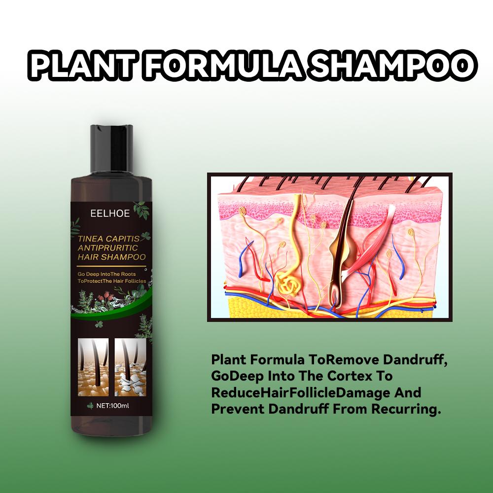EELHOE Anti-Dandruff and Hair Loss Prevention Shampoo - Image 3