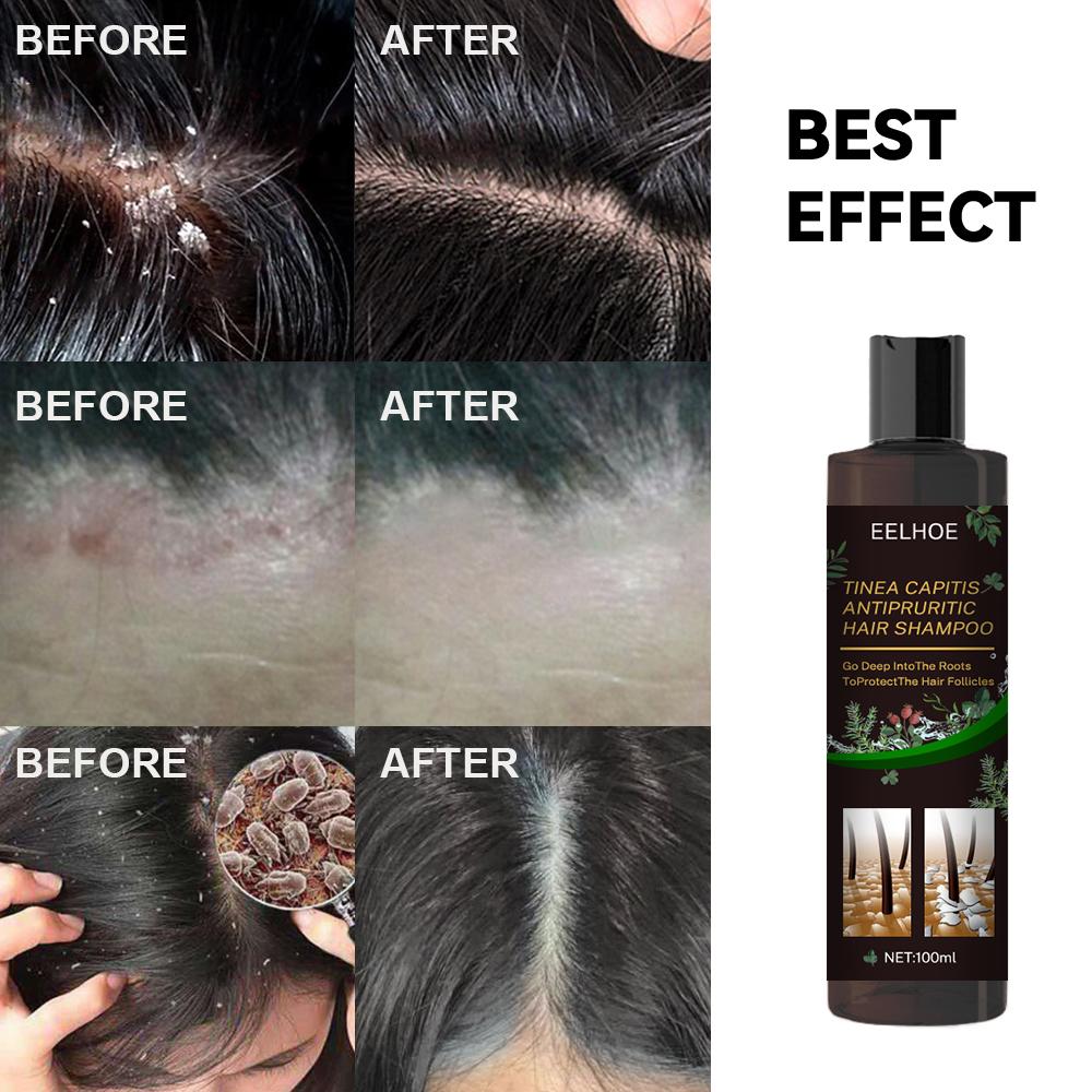 EELHOE Anti-Dandruff and Hair Loss Prevention Shampoo - Image 4