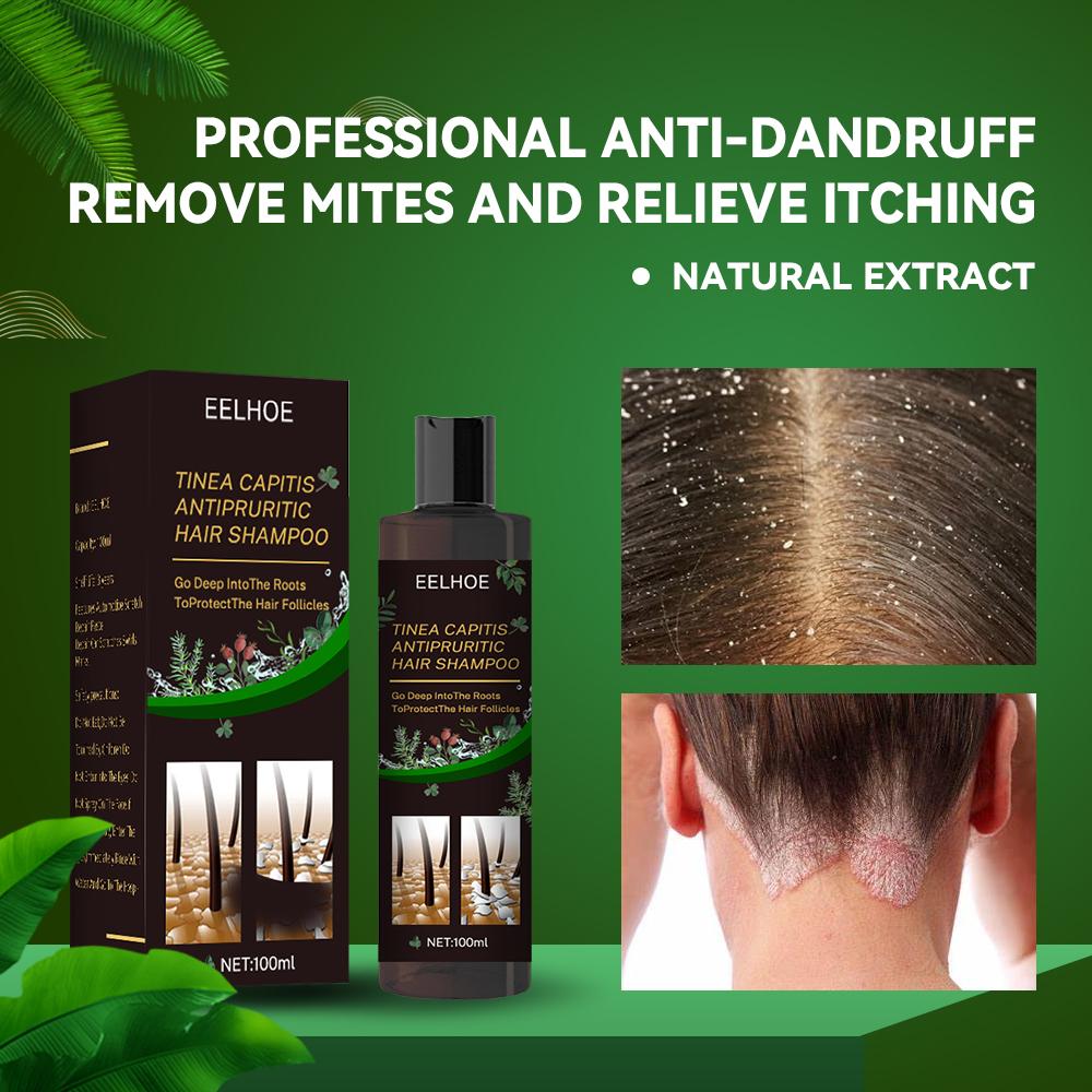 EELHOE Anti-Dandruff and Hair Loss Prevention Shampoo - Image 5