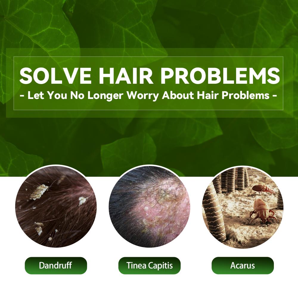 EELHOE Anti-Dandruff and Hair Loss Prevention Shampoo - Image 6